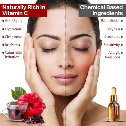 Hibiscus Tea ( 50 gm of 2 jar) | SKIN GLOW ENHANCING TEA | Flower Based - Herbal Tea - Caffeine Free - Tangy Flavor - Non-GMO |